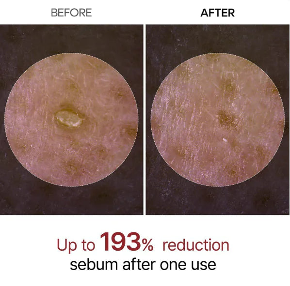 Glow Rice Peeling Ampulle