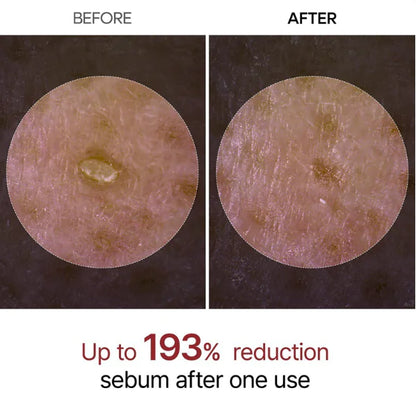 Glow Rice Peeling Ampulle